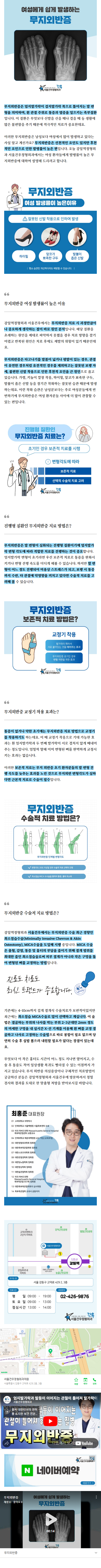 발목골절수술 gsvug