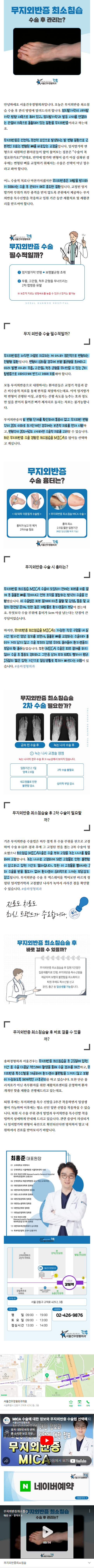 발목인대봉합술 jisxg