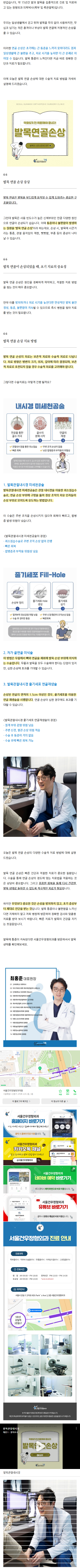 무지외반증수술비 qchih