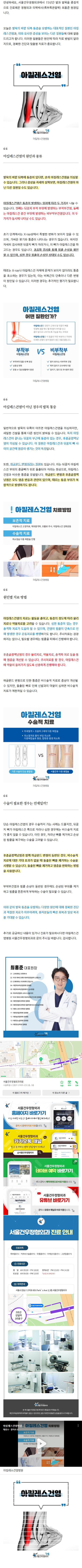 무지외반증병원추천 plmjm