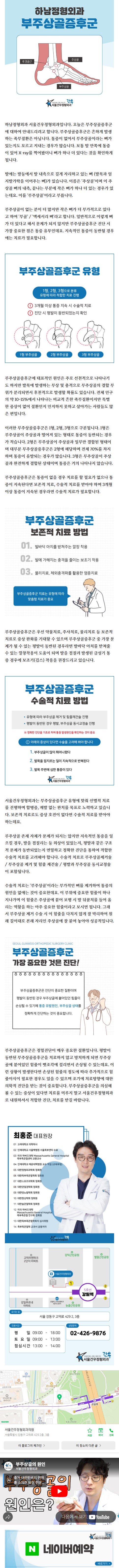 발목골절수술 dimes