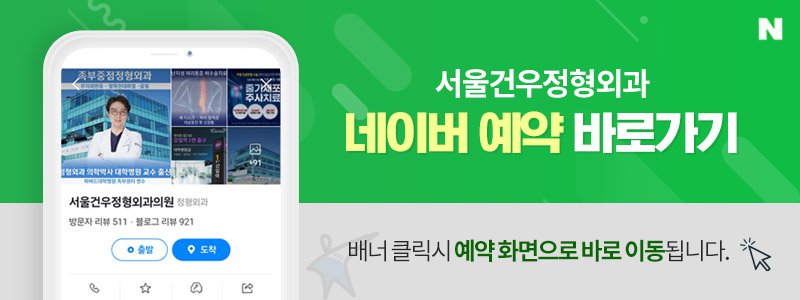 서울 족부 재건수술